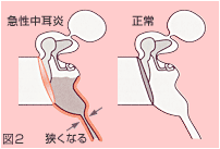 なぜ耳管が機能しなくなるの？